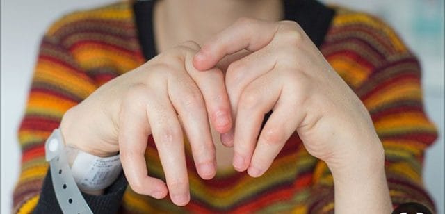 Kırılgan tırnakları tedavi etmenin doğal yolları nasıl yapılır? İşte cevabı